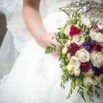 , Simple Cosmetic Treatments to Help You Look Good on Your Wedding Day